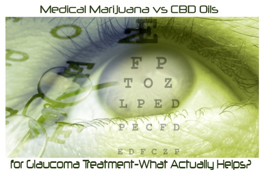 Medical Marijuana vs CBD Oils for Glaucoma Treatment
